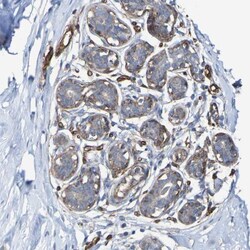 anti-RBED1, Polyclonal, Novus Biologicals 0.1mL; Unlabeled:Antibodies,